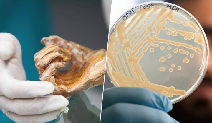 Ancient Yeast Found Alive in 5,300-Year-Old “Iceman” Ötzi Offers Clues to Life’s Extremes and Human Health