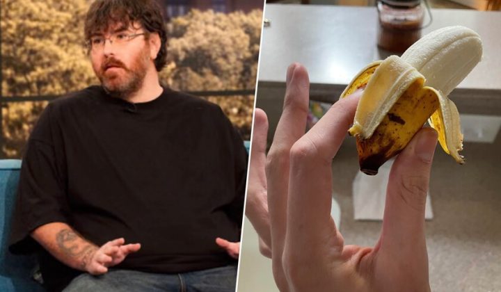 Viral Social Media Post Sparks Medical Awareness and Funding for Man with Micropenis