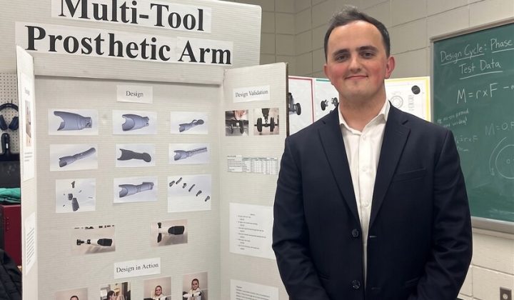Student Develops Multifunctional 3D-Printed Prosthetic Arm for Sister