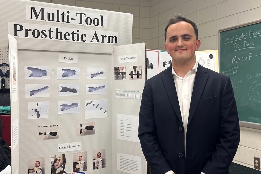 Student Develops Multifunctional 3D-Printed Prosthetic Arm for Sister